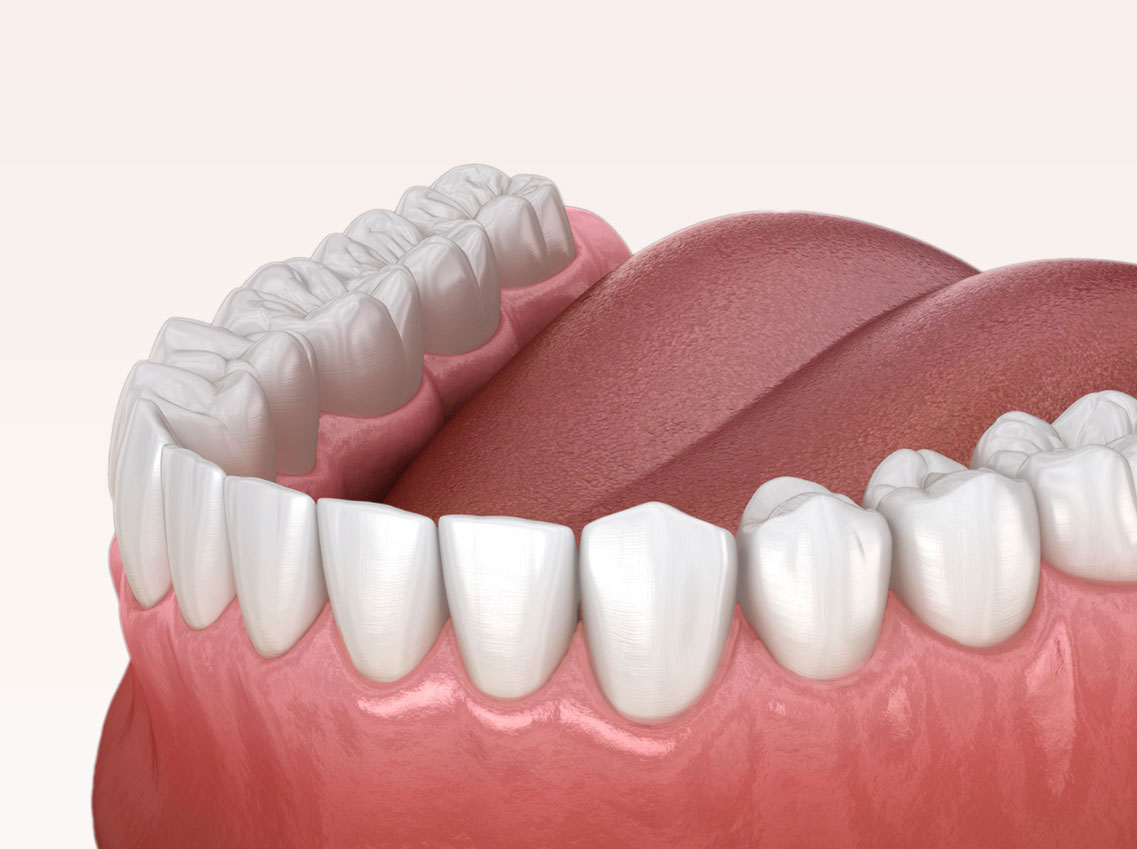 Zahnreinigung Dentalreinigung Köniz
